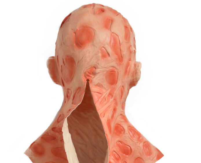 Realistic sculpted mask resembling burn scars and lesions, with a jagged opening at the back. The mask's texture is detailed with reddish tones and uneven surfaces.